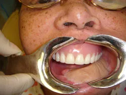 Oral Cancer Case Study photo